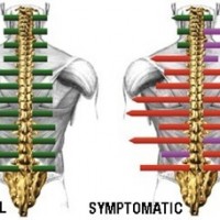 Image of a print our in colour of spinal scan for patient