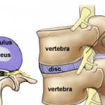Image of anatomy of spine and disc