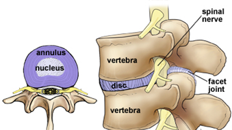 Disc image | Archview Physiotherapy | Massage | Dry Needling | Pilates