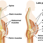 pregnancy low back pain