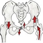 Pelvic mal-alignment